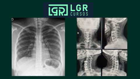 Posicionamento Radiográfico